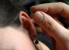 acupunctuur oor-acupunctuur