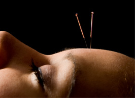 acupunctuur arts schedel acupunctuur