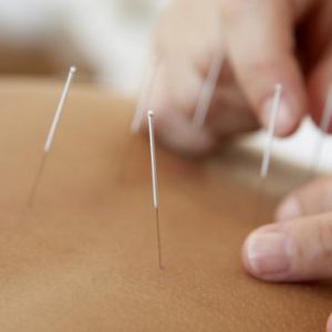 Stres en burnout Acupunctuur